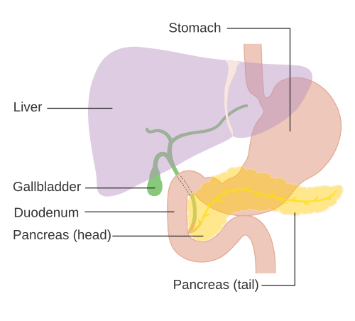 Pancreatic cancer